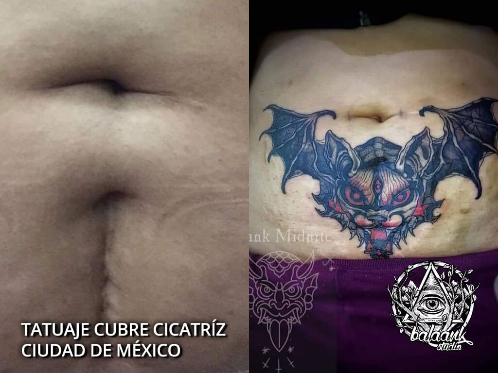 Tatuaje cubre Cicatríz Ciudad de México